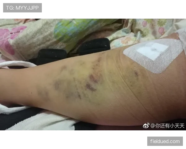 身体冲撞判罚：合法肩撞与犯规界限解析